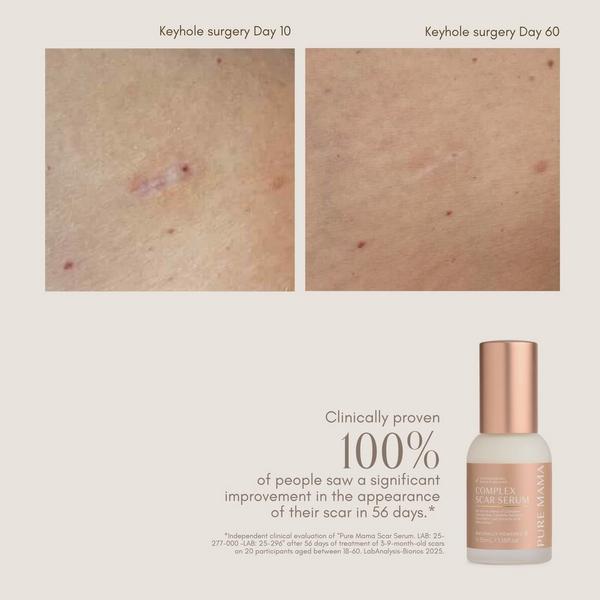 Pure Mama Complex Scar Serum #5