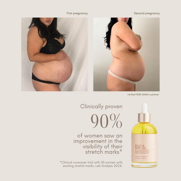 Pure Mama Bump Love Set #5