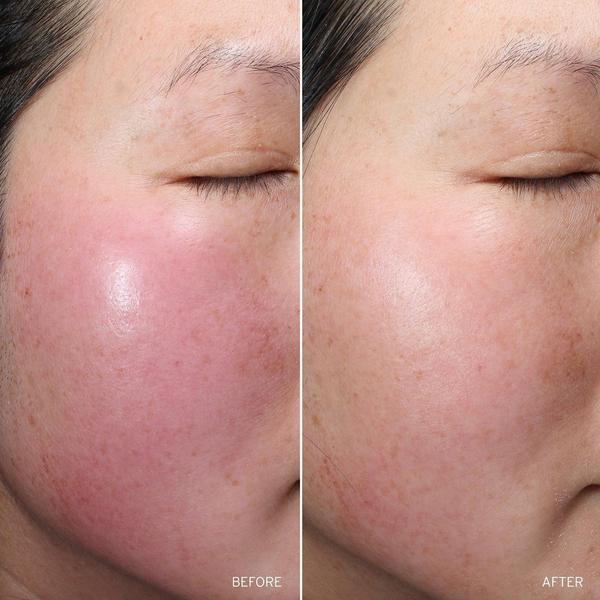 Aramore NAD+ Renew & Restore Bundle #7