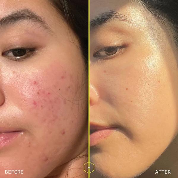 Aramore Retinol Peptide Boosting Serum #6