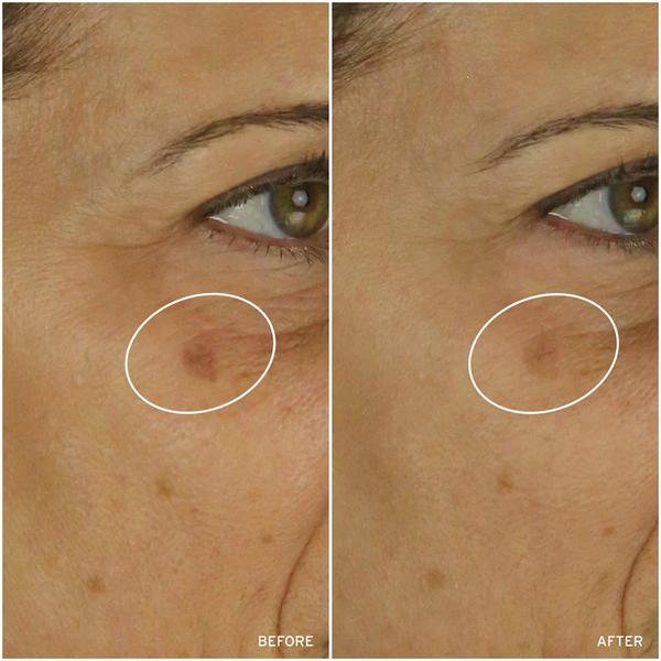 Aramore NAD+ Skin Transformation Set #4