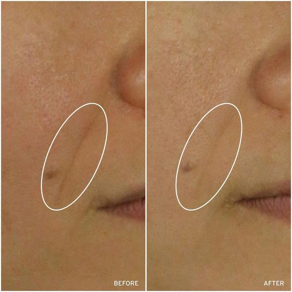 Aramore NAD+ Skin Transformation Set #5
