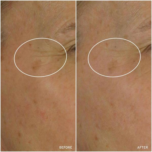 Aramore NAD+ Cell Energizing Treatment #5