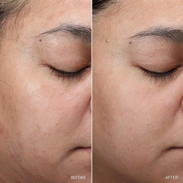 Aramore NAD+ Cell Restoration Cream #5