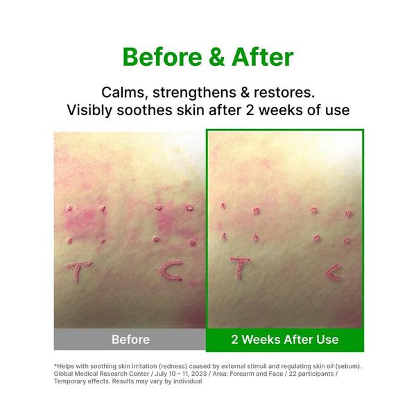 Madeca Derma Phyto Calming Microbiome Ampoule #7