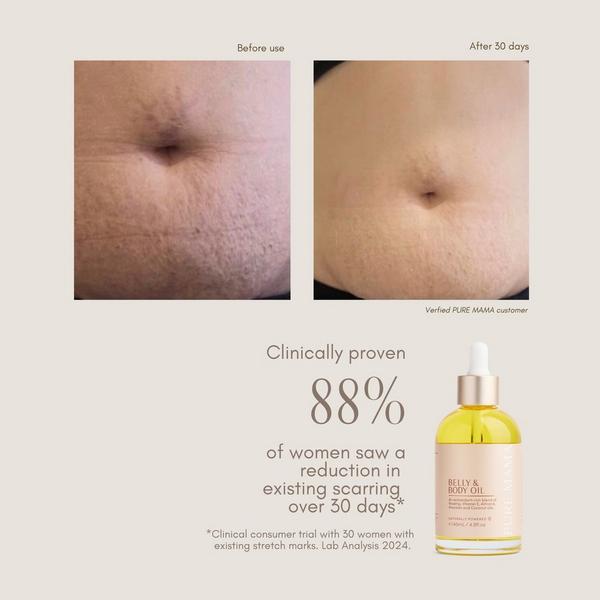 Pure Mama Belly & Body Oil #7