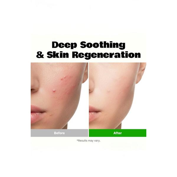 LALARECIPE PDRN Melting Gel Mask - Set of 4 #6