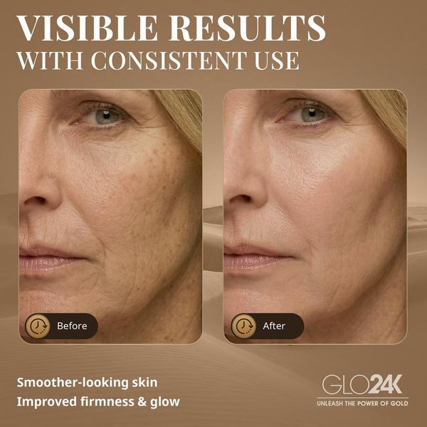 Glo24k Skin Rejuvenation Device with Conductive Hydra Gel #3