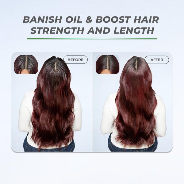 XMONDO BOOST X Dry Shampoo + Scalp Care #5