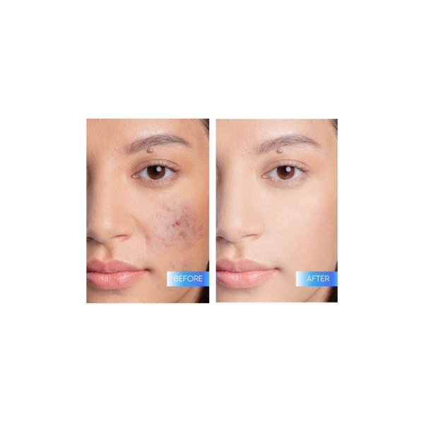 Skintific 5X Ceramide Barrier Moisture Gel #3
