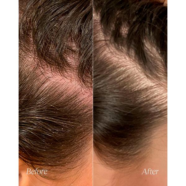 Monpure Hydrate and Soothe Scalp Serum #5
