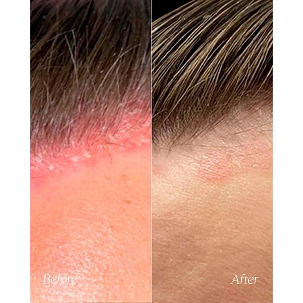 Monpure Hydrate and Soothe Scalp Serum #6