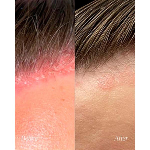 Monpure Clarifying Scalp Scrub #4