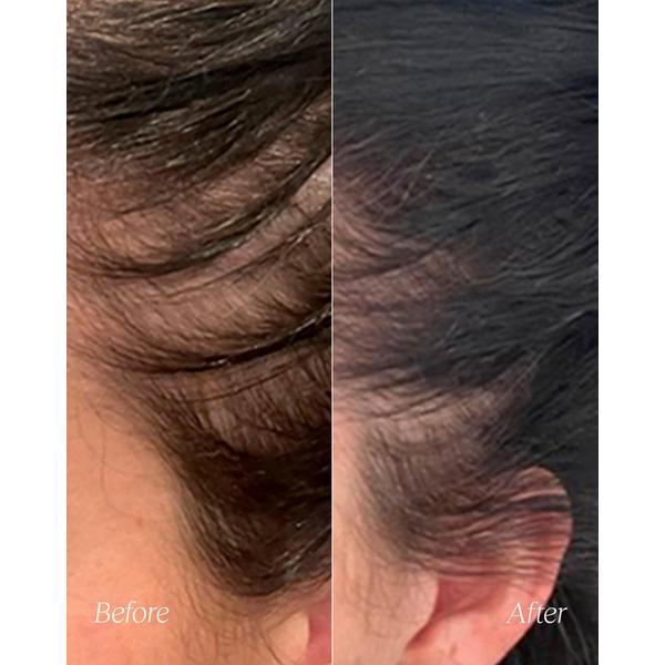 Monpure Nourish and Stimulate Scalp Mask #4