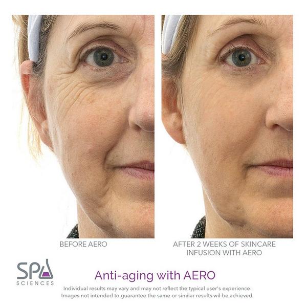 Spa Sciences AERO Advanced Skincare Infusion System #5