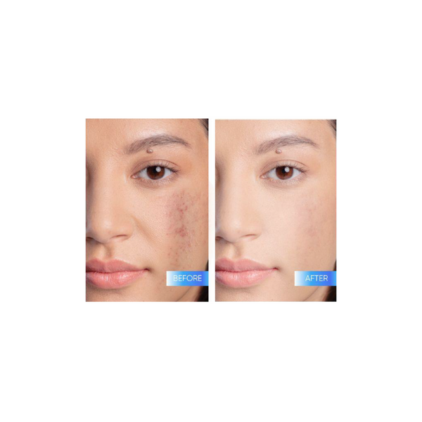 Skintific 5X Ceramide Barrier Serum #3