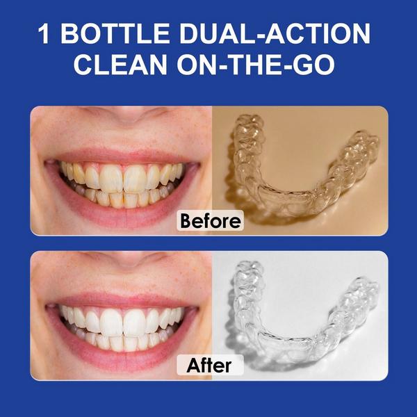 MySmile 2-in-1 Aligner Cleaner & Whitening Foam #2