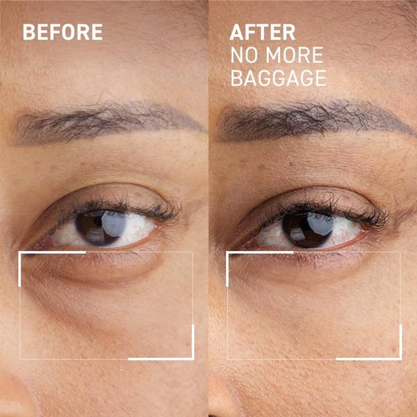 Dr. Brandt No More Baggage #2