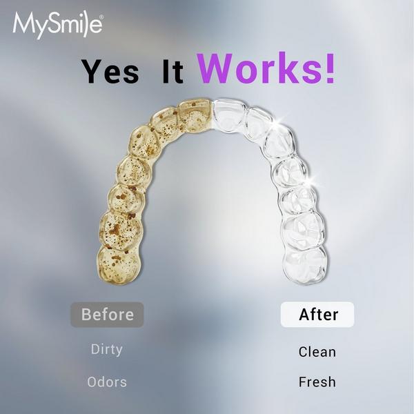 MySmile MS202B Cordless Ultrasonic Retainer & Jewelry Cleaning Pod with Digital Timer #2