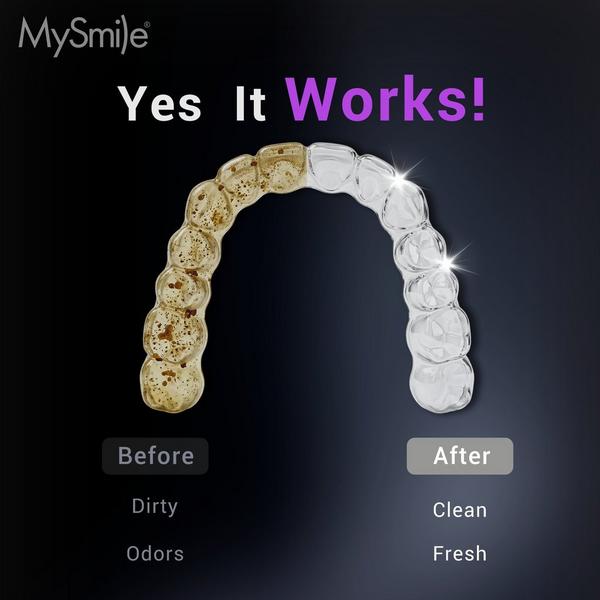 MySmile MS202B Cordless Ultrasonic Retainer & Jewelry Cleaning Pod with Digital Timer #2