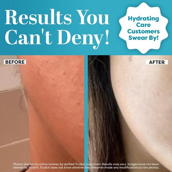 TruSkin Hyaluronic Acid Facial Serum #3