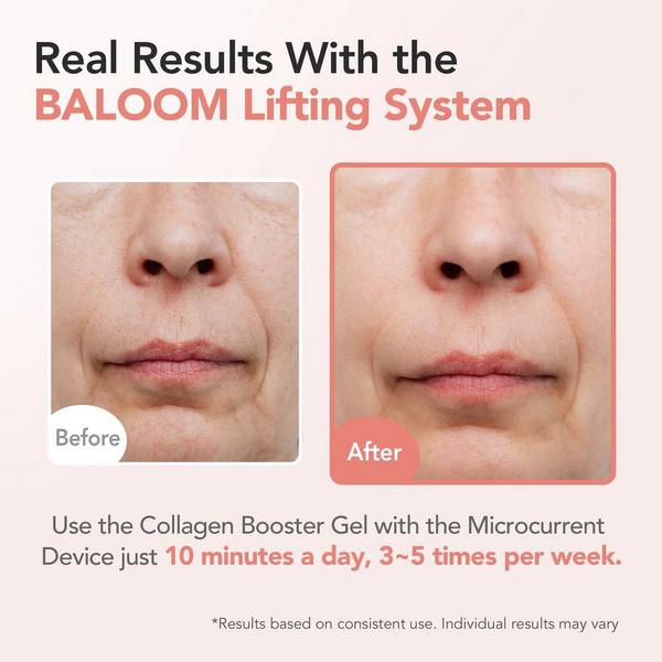 Baloom Microcurrent Face Massager & Collagen Booster Gel Set #3
