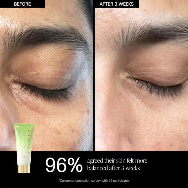 BYROE Your Skin’s Green Flag #8