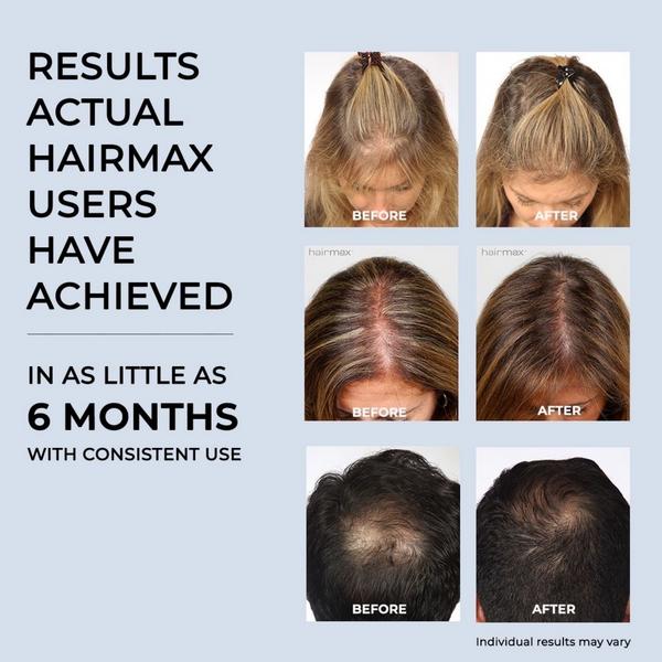 Hairmax Ultima 9 Classic LaserComb #6