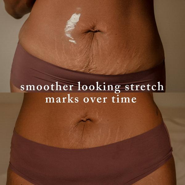 Nēmah Revitalizing Stretch Mark Cream #6