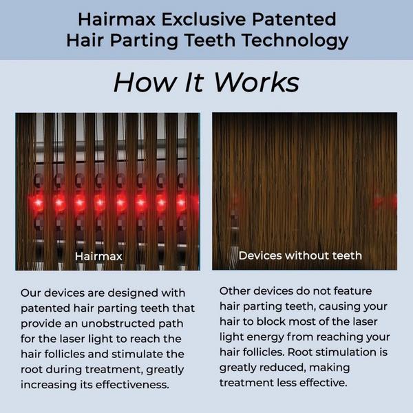 Hairmax Ultima 12 LaserComb #5