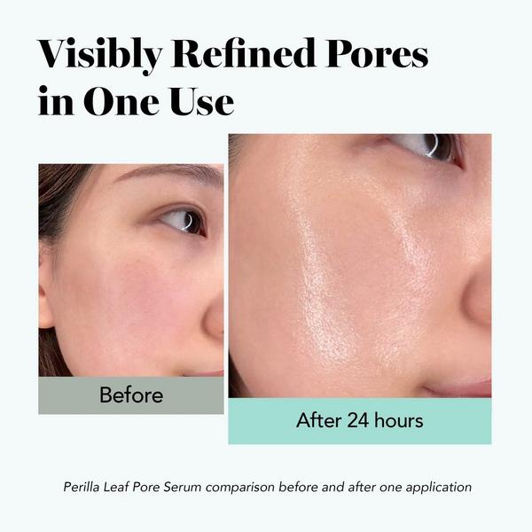 Saturday Skin Perilla Leaf Pore Minimizing Serum with Cica and Tea Tree #5