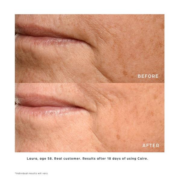 Caire Beauty Theorem Serum Boost #6