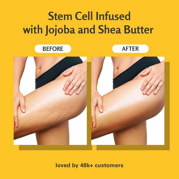 M3 Anti-Cellulite Body Scrub #6