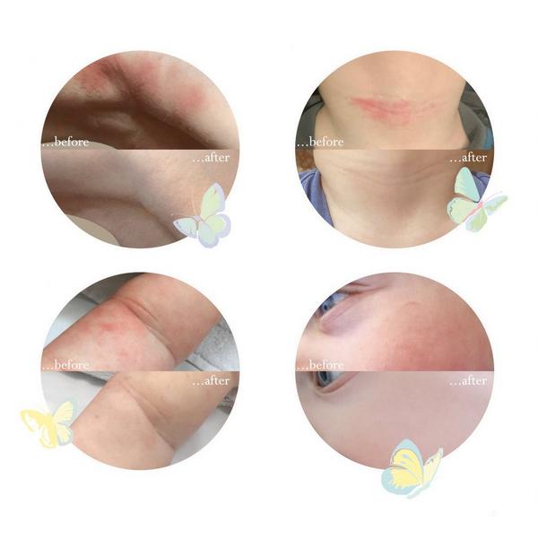 Little Butterfly London Wrapped in Love Calming Anti-Pollution Baby Face Cream #4