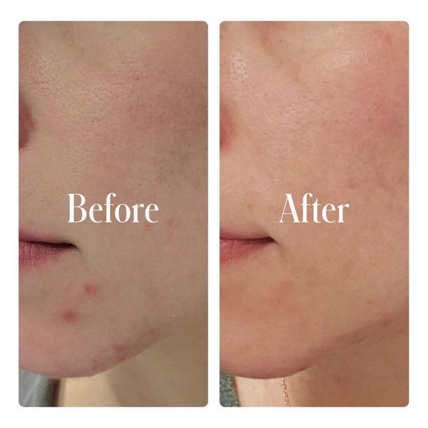 Geologie Clear System Face Routine #4