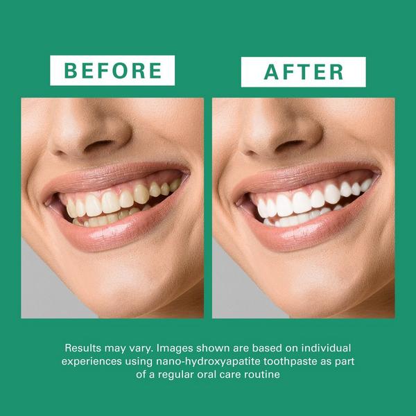 M3 Nano Hydroxyapatite Calcium Toothpaste #7