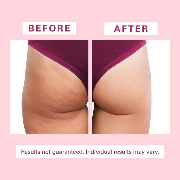 M3 Cellulite Silicon Body Brush #2