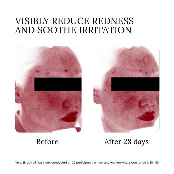 elvis+elvin Rose Revitalizing Treatment Mask 3.0 #5