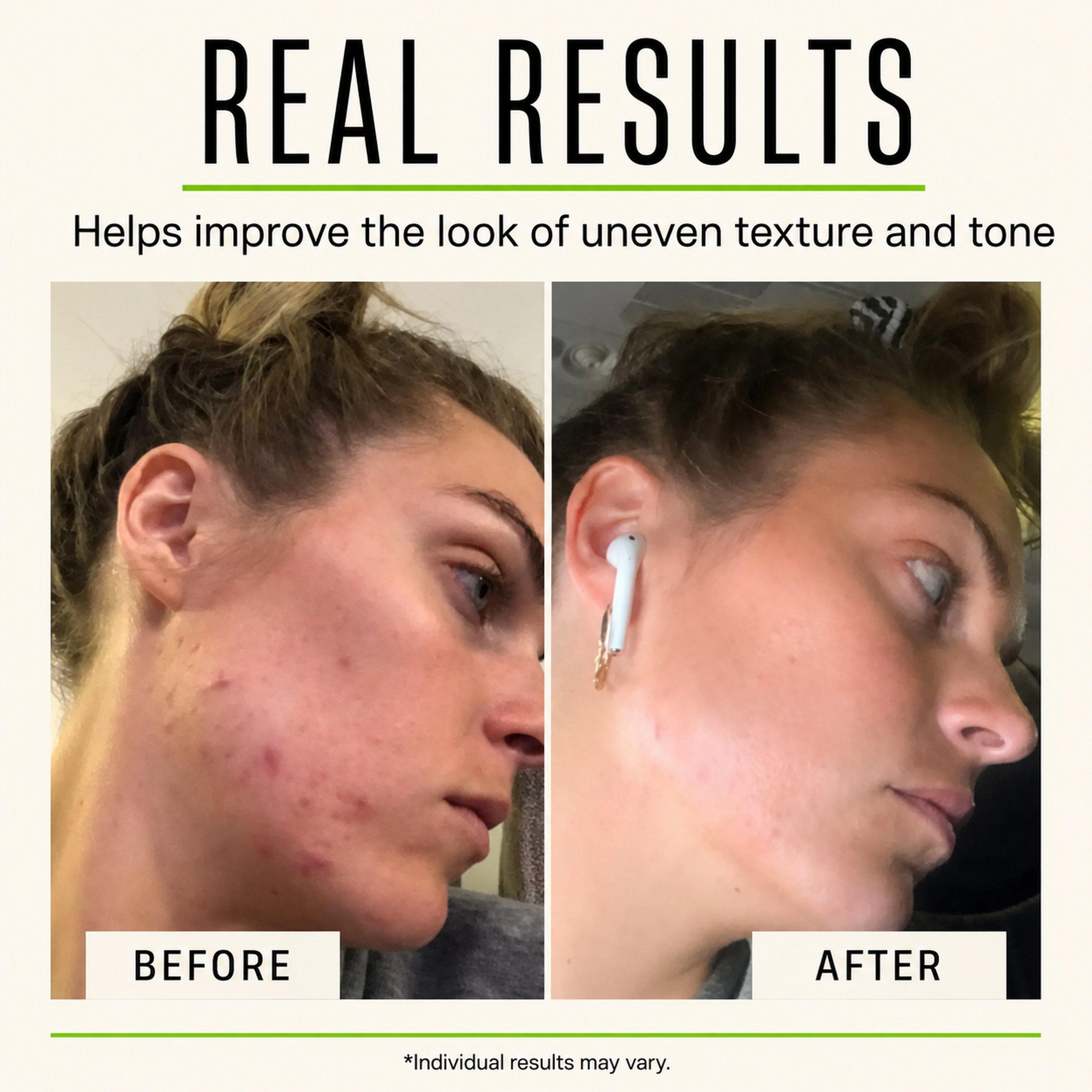 Пилинг для лица с гликолевой кислотой 30% Yeouth Skincare — фото 4