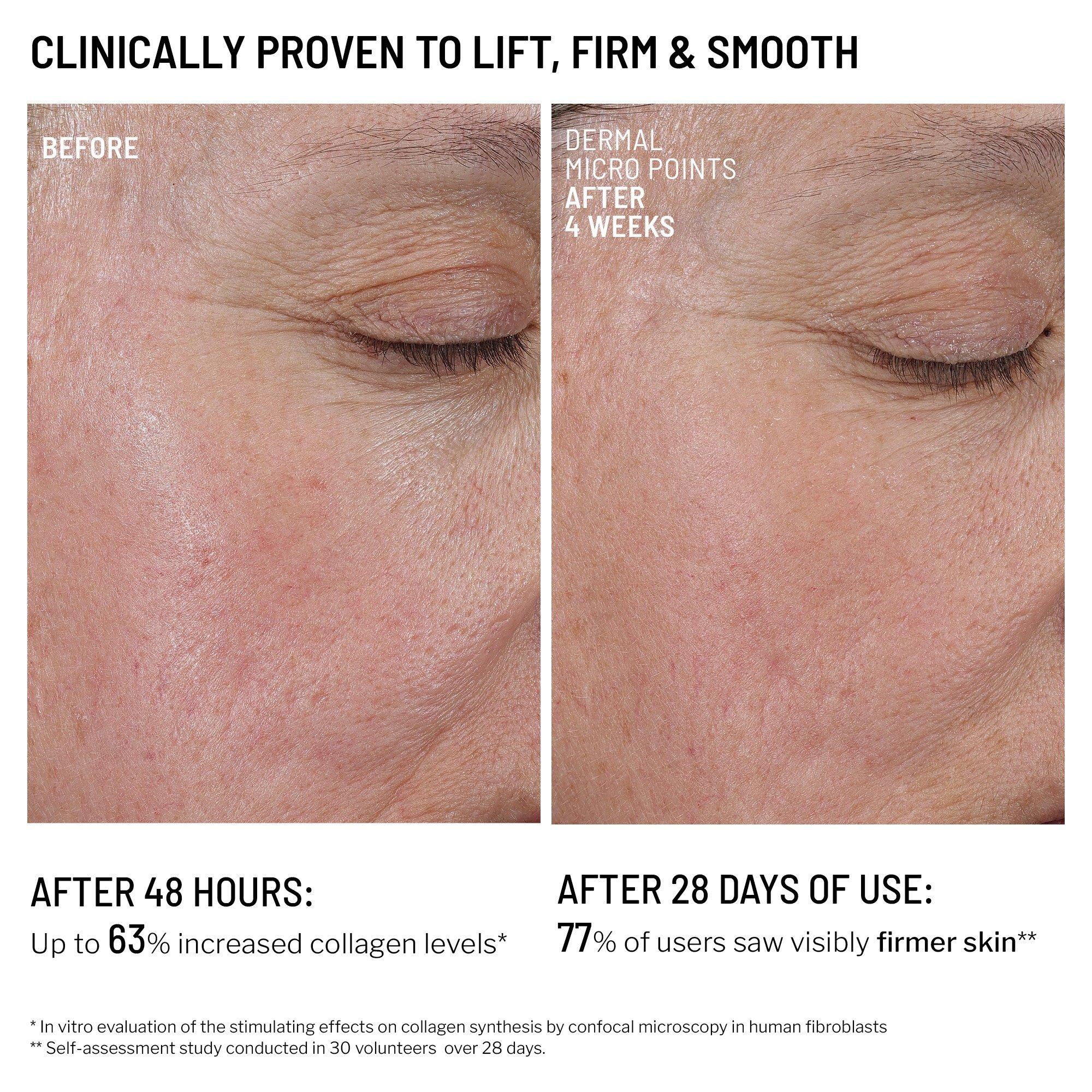 Dr. Brandt Needle Free Holiday Duo — фото 8