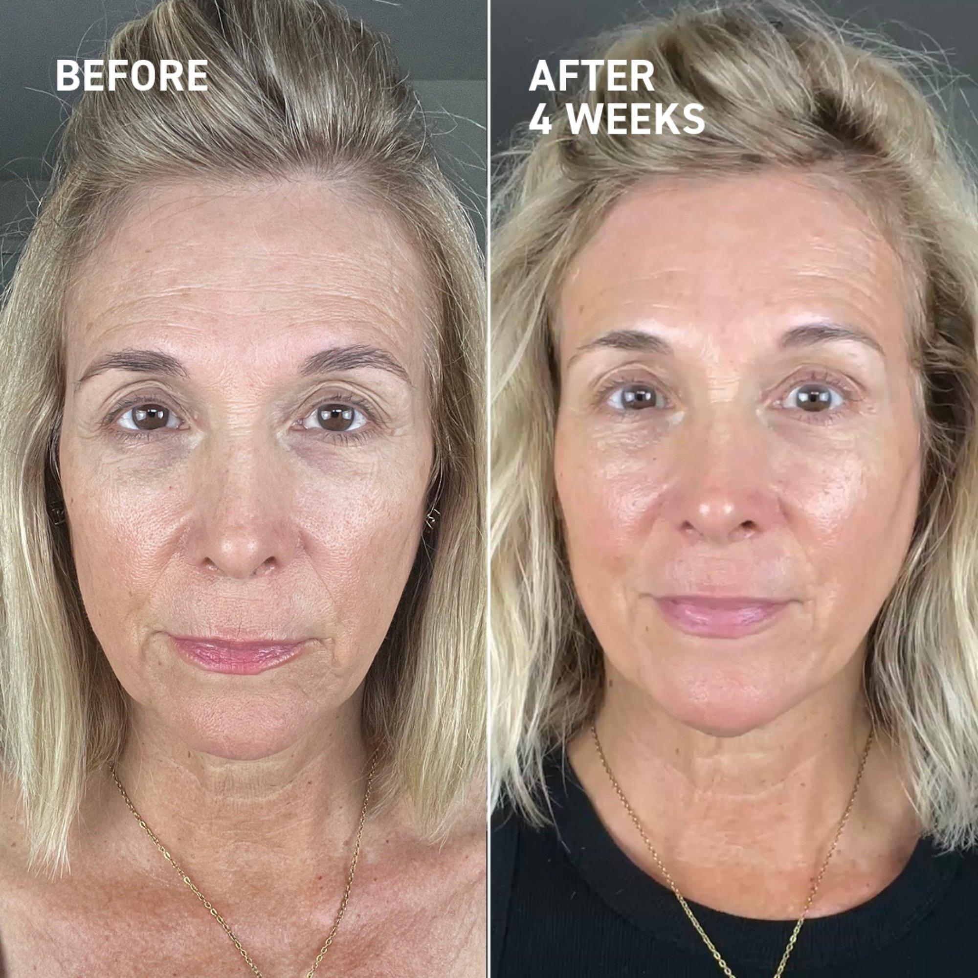Dr. Brandt Microneedling Recovery Holiday Duo — фото 3