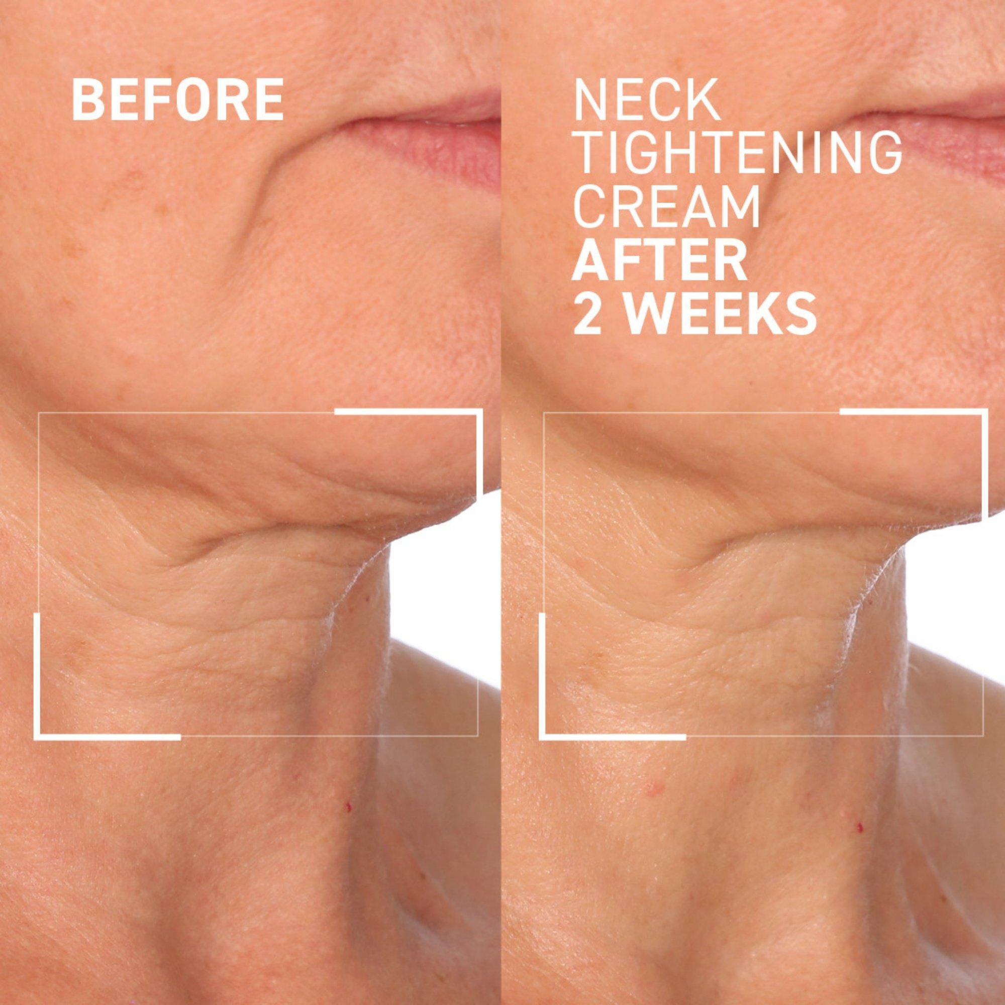 Dr. Brandt Face & Neck Lifting Holiday Duo — фото 4