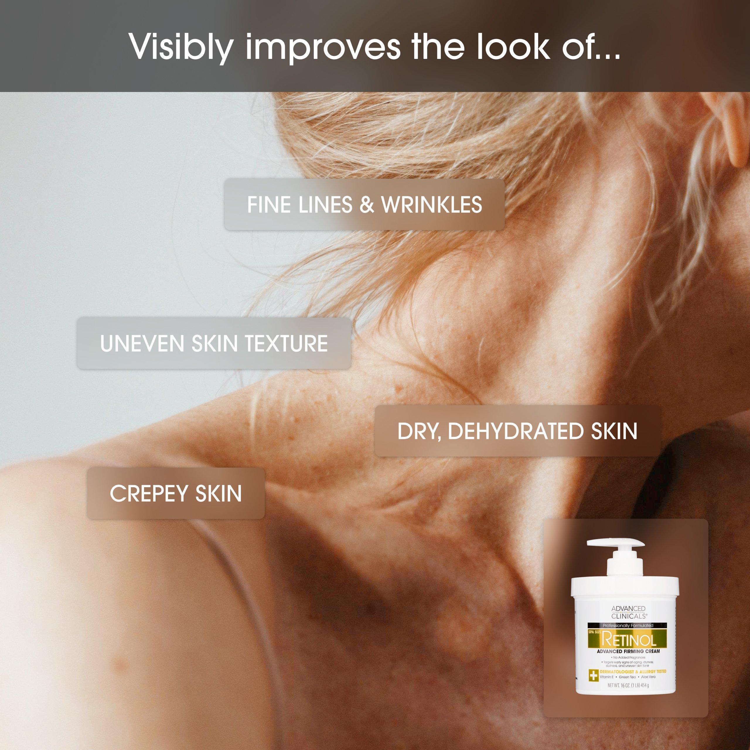 Укрепляющий крем для тела Advanced Clinicals Retinol — фото 6