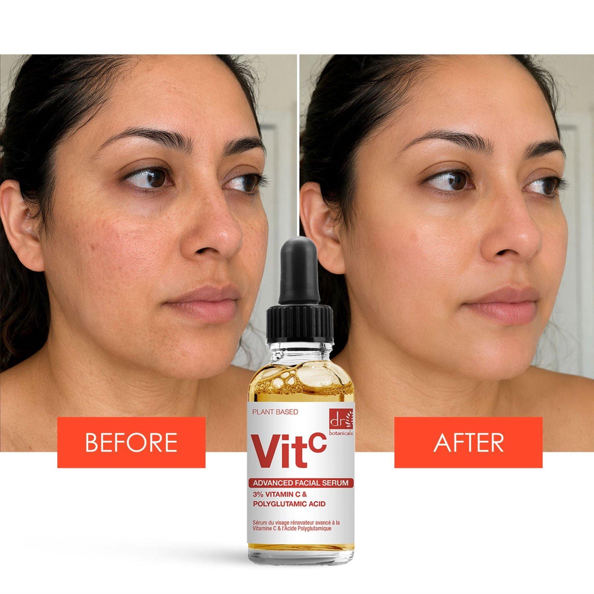 Омолаживающая сыворотка для лица Dr Botanicals Advanced — фото 2