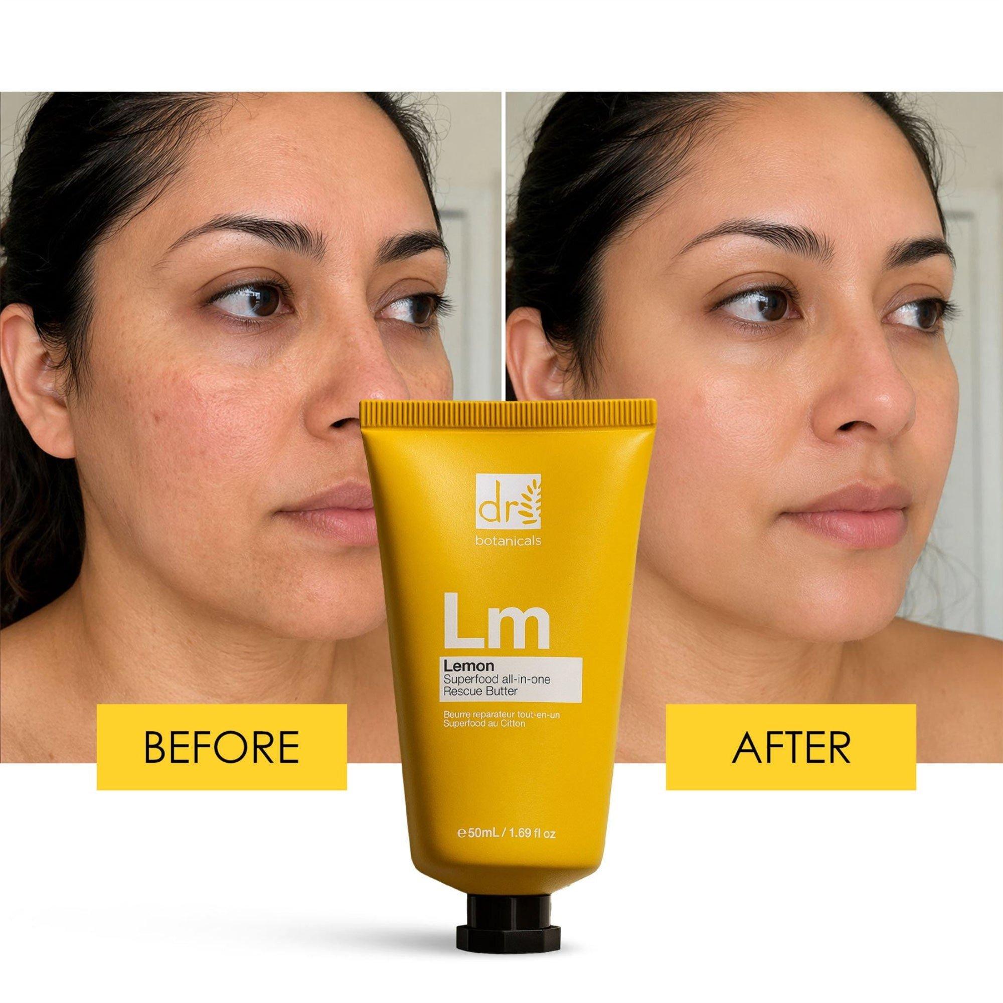 Антивозрастное универсальное масло для тела Dr Botanicals Lemon Superfood — фото 3