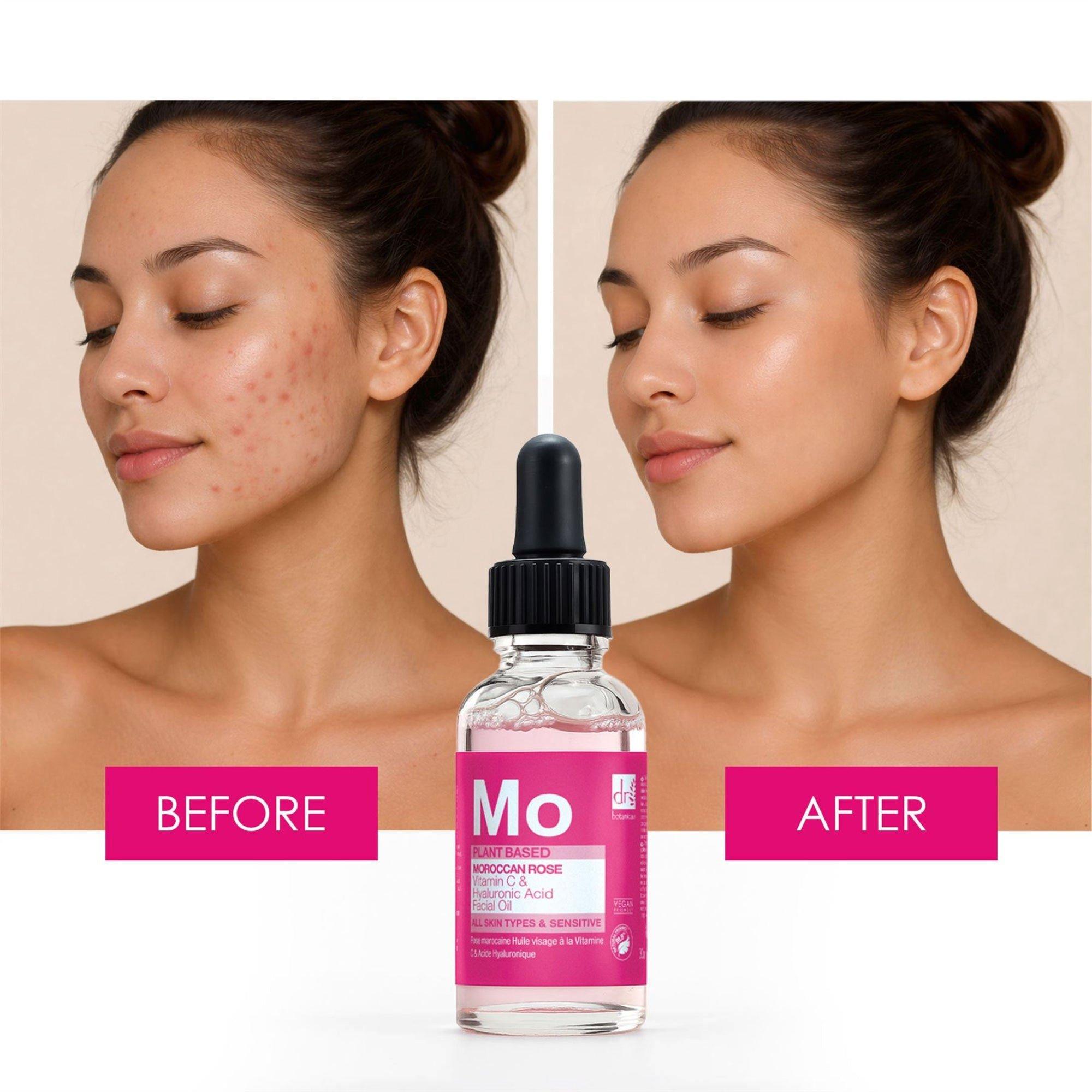 Омолаживающее масло для лица Dr Botanicals Moroccan Rose — фото 3