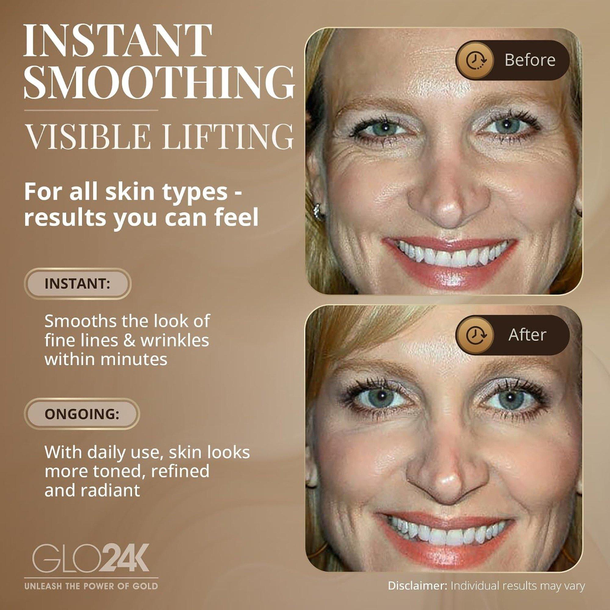 Glo24k Instant Wrinkle Filler & Lifting Cream — фото 5