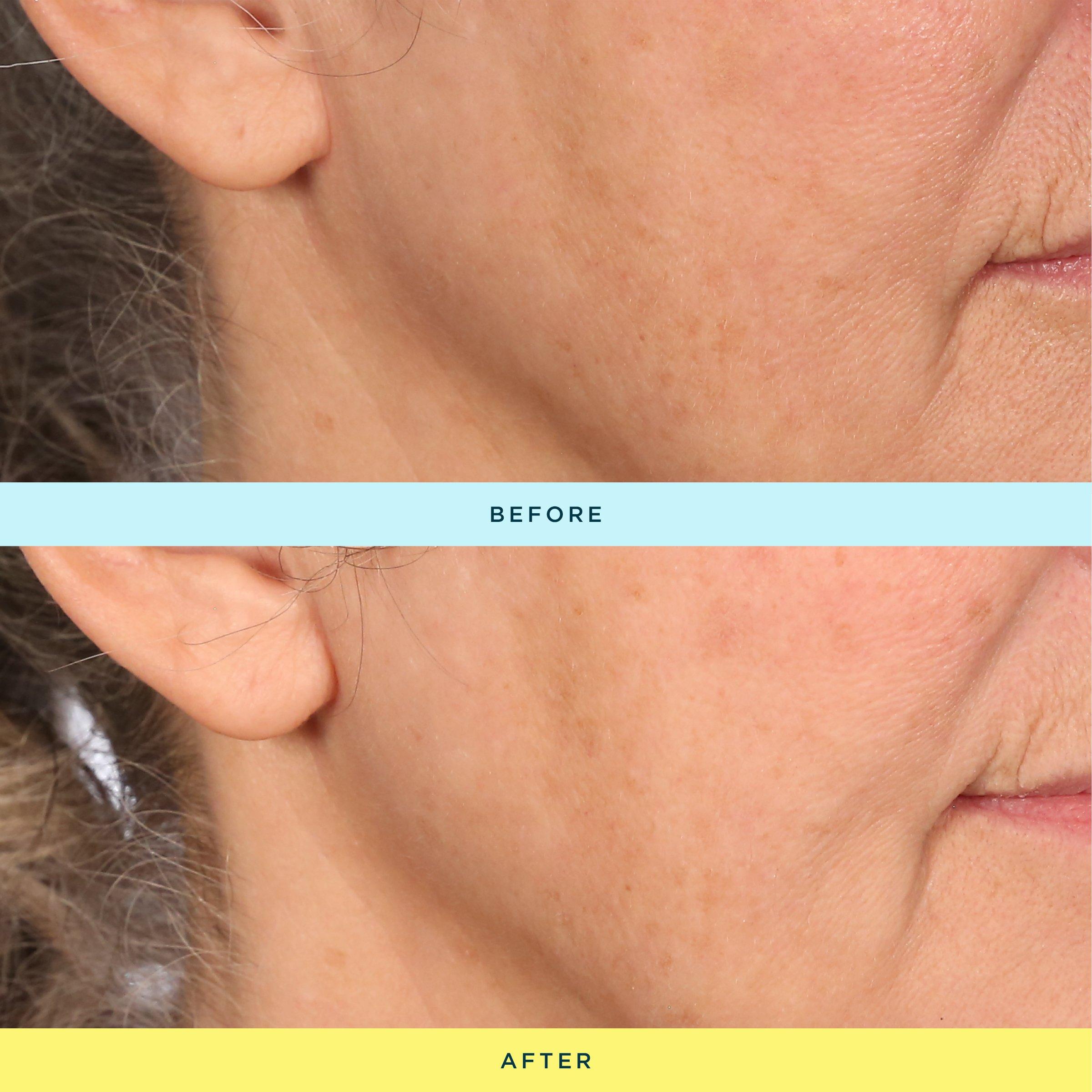 Сыворотка с 10% витамина C Fré Skincare C ME — фото 4