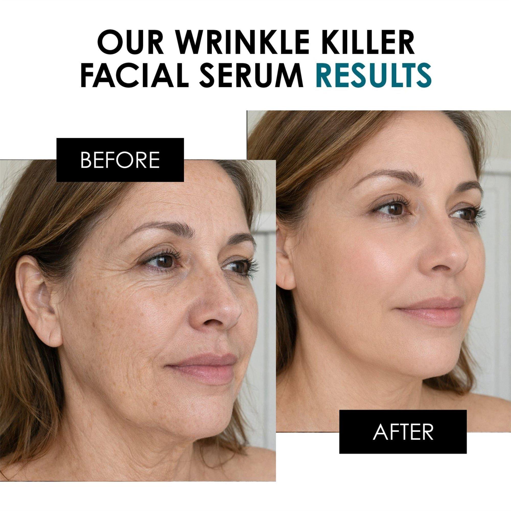 skinChemists Wrinkle Killer Anti-Aging Facial Serum — фото 3