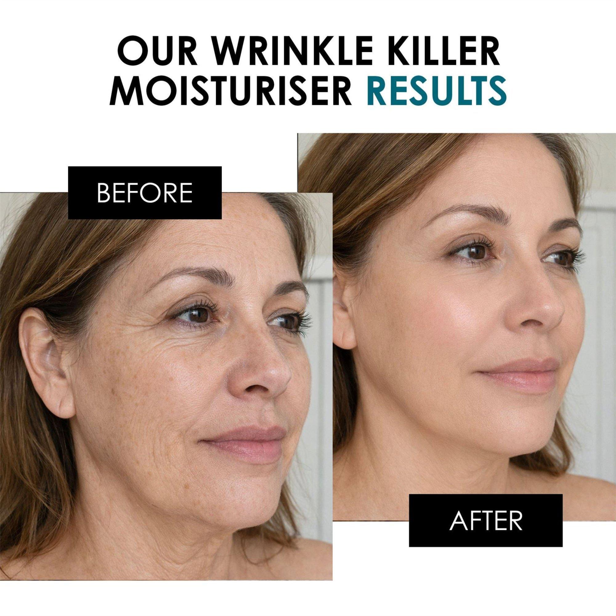 skinChemists Anti-Aging Wrinkle Killer Night Moisturiser — фото 3